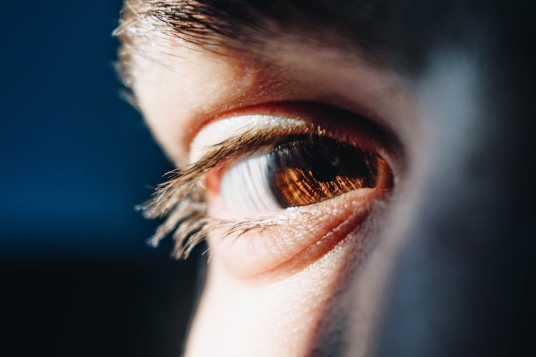 Blépharoplastie